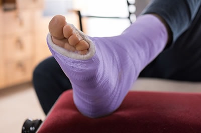 foot and ankle fractures in the Arapahoe County, CO: Littleton, Englewood; Denver County, CO:  Denver;  Jefferson County, CO: Lakewood and Douglas County: Lone Tree, Roxborough Park, Parker, Castle Pines areas